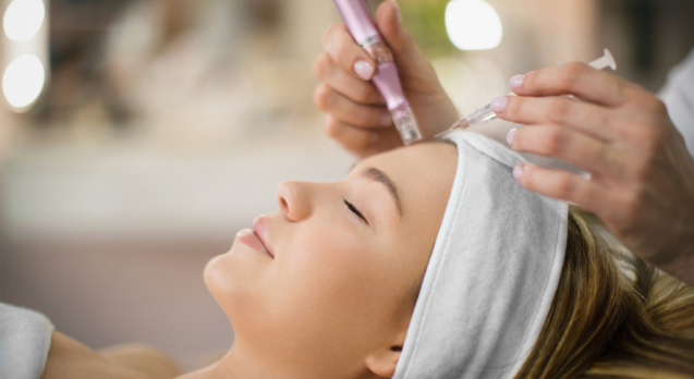 micro needling
